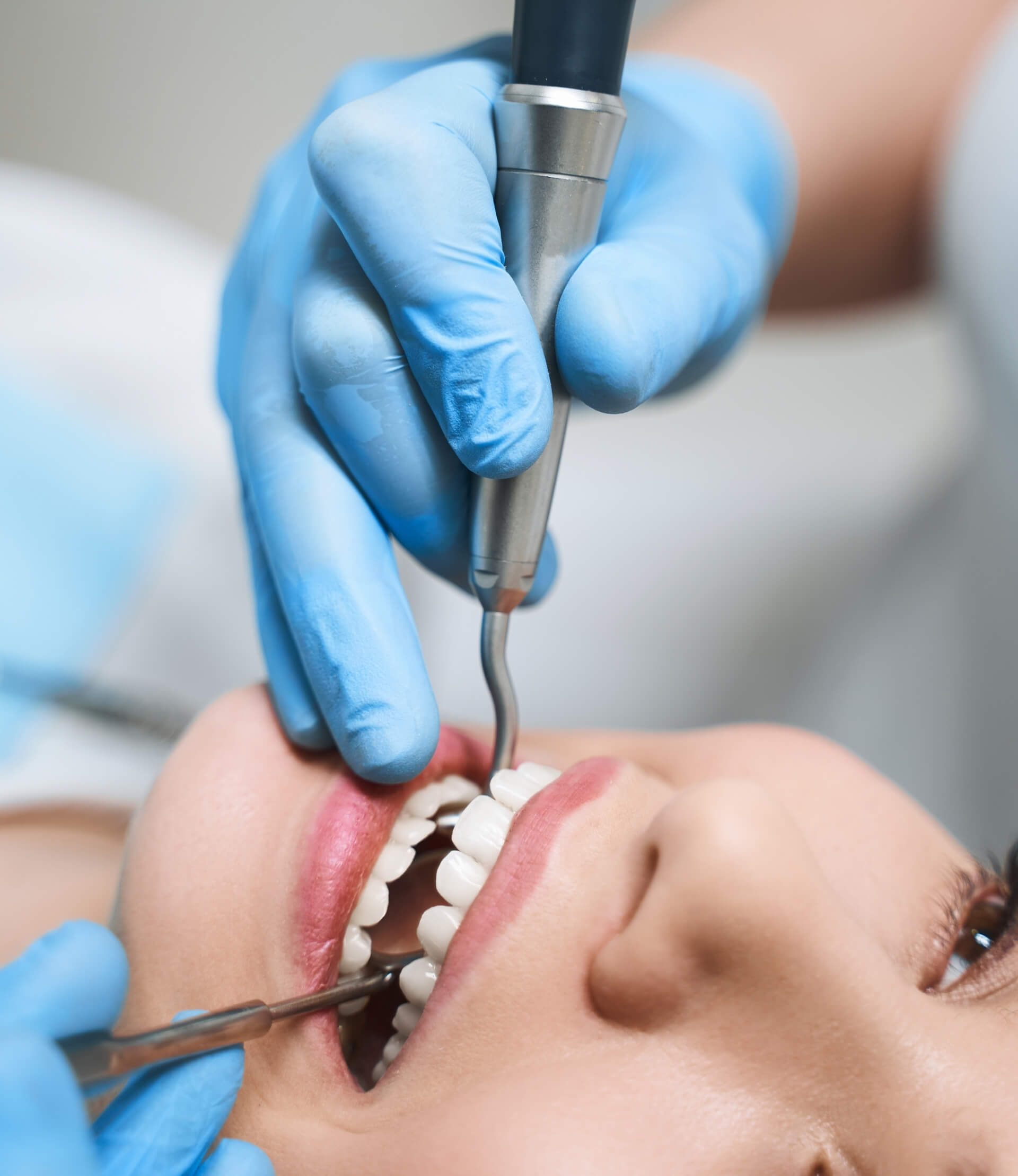 Kanal Tedavisi (Endodonti)