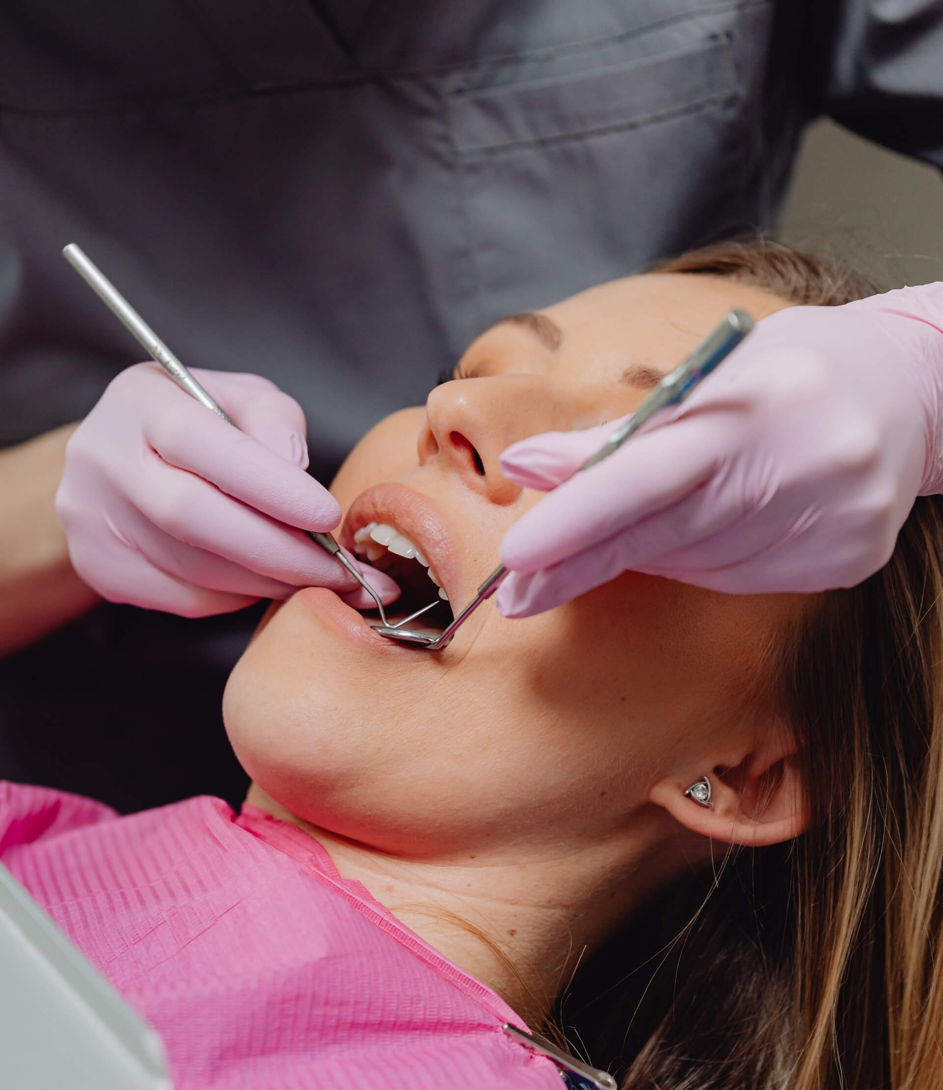 Gömülü Diş Çekimi