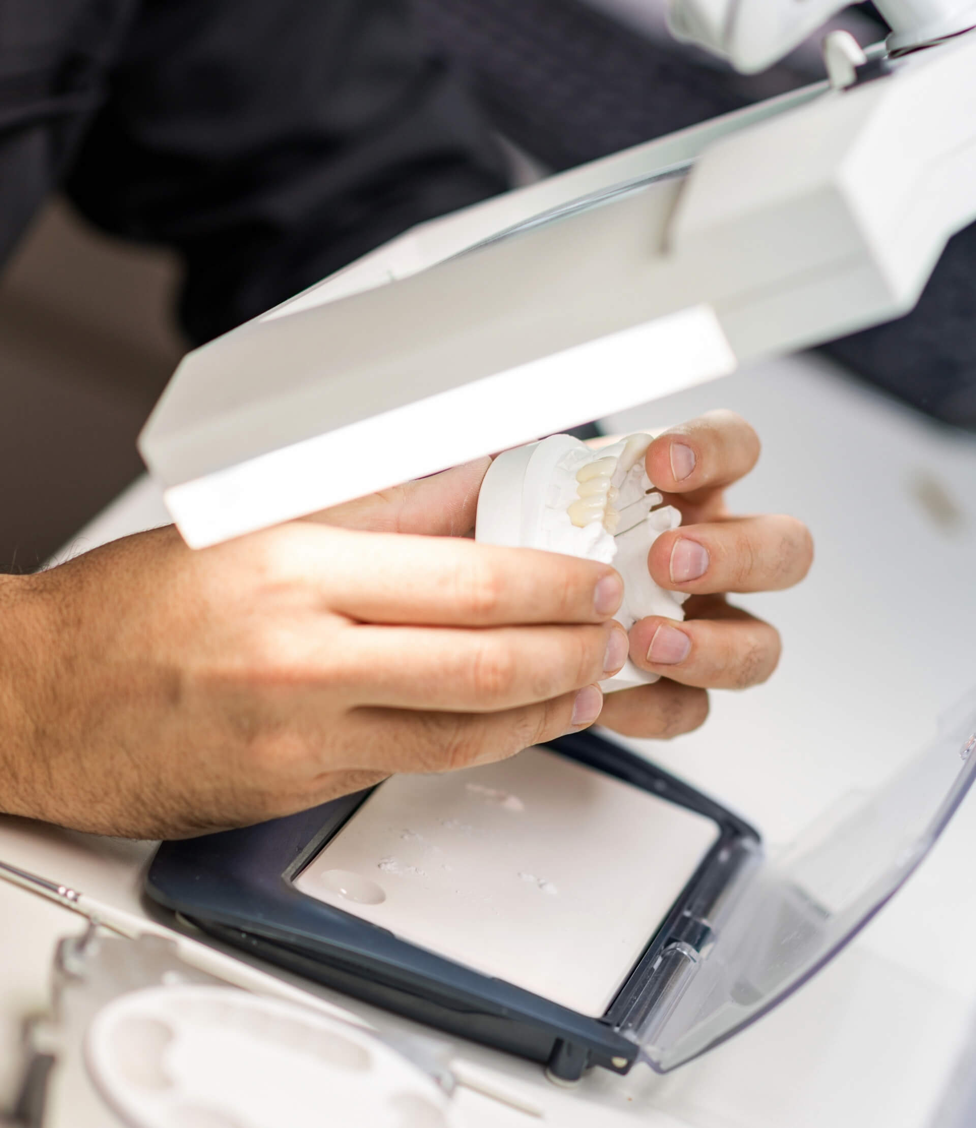 Protetik Diş Tedavisi ve Gülüş Tasarımı